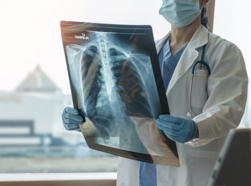 Röntgen asszisztens