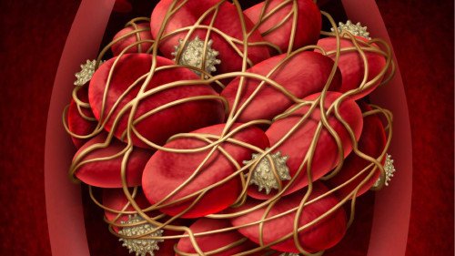 Fokozott véralvadási készség