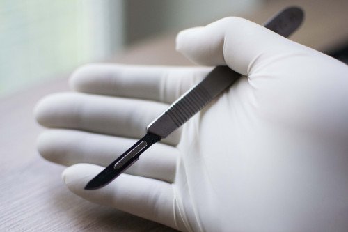 A PROKTOLÓGIÁTÓL AZ ANYAJEGY ELTÁVOLÍTÁSIG: ISMERJE MEG SEBÉSZETI SZAKRENDELÉSÜNKET!