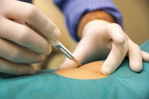 PLASZTIKAI SEBÉSZET INDUL A KAPOS MEDICALNÁL