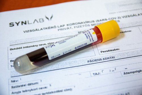 COVID-19 IGG ELLENANYAG KIMUTATÁSA A KAPOS MEDICALNÁL