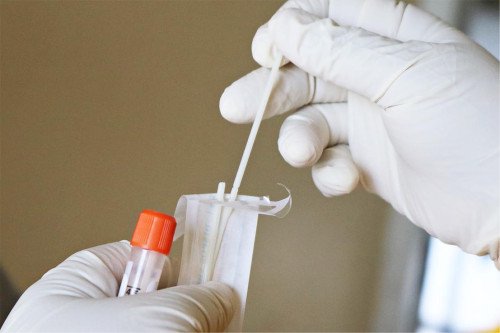 PCR TESZT A KAPOS MEDICALNÁL