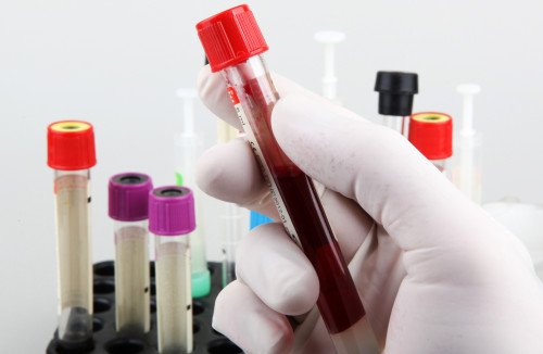 MINDEN EDDIGINÉL TÖBB VIZSGÁLAT ÉRHETŐ EL A TRITONLIFE KAPOS MEDICALNÁL!